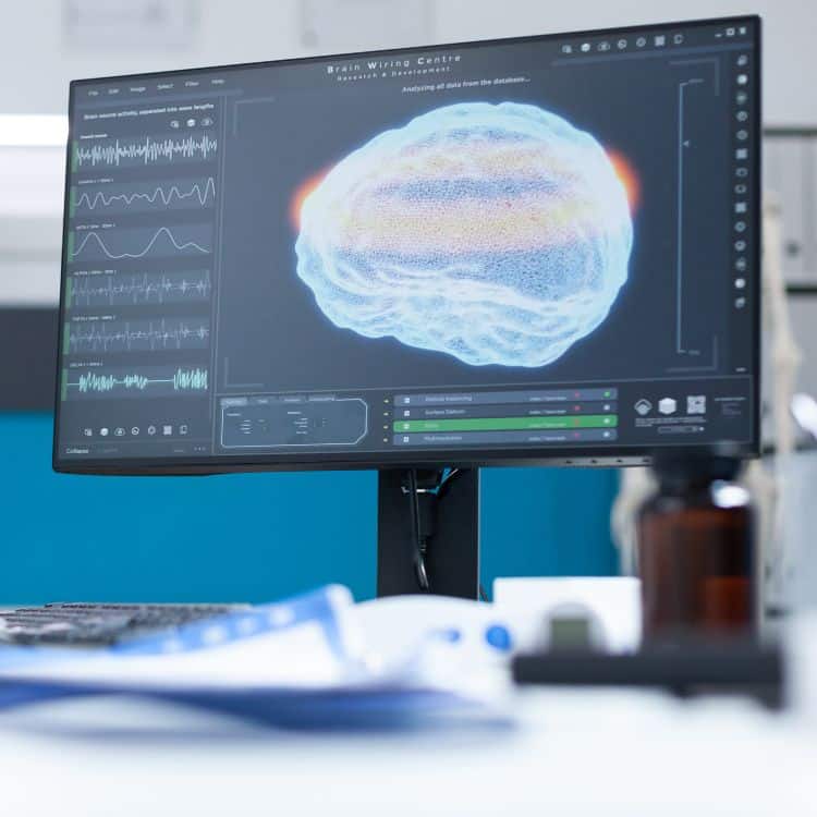 image of brain scan on computer